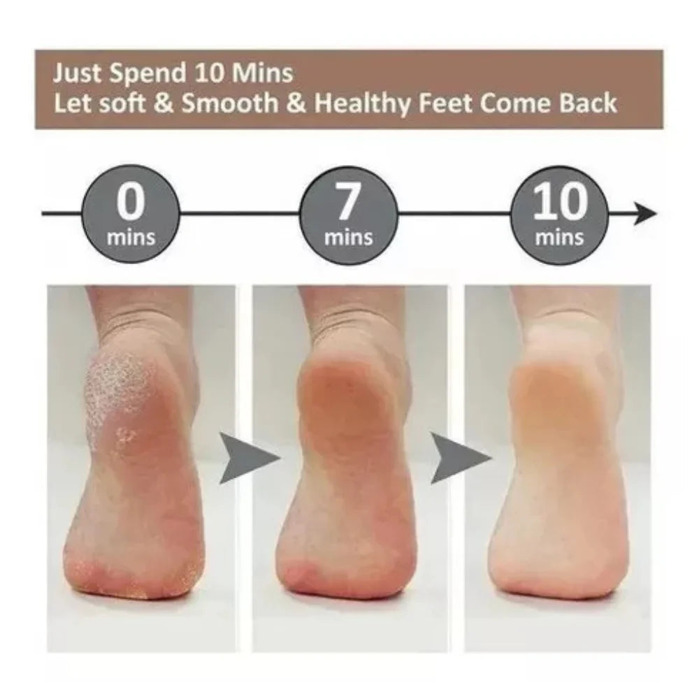 Electric Callus Remover - Portable Foot Sander