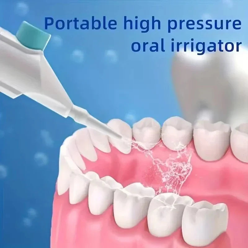 Portable Manual Oral Irrigator – High-Pressure Water Flosser for Deep Dental Cleaning